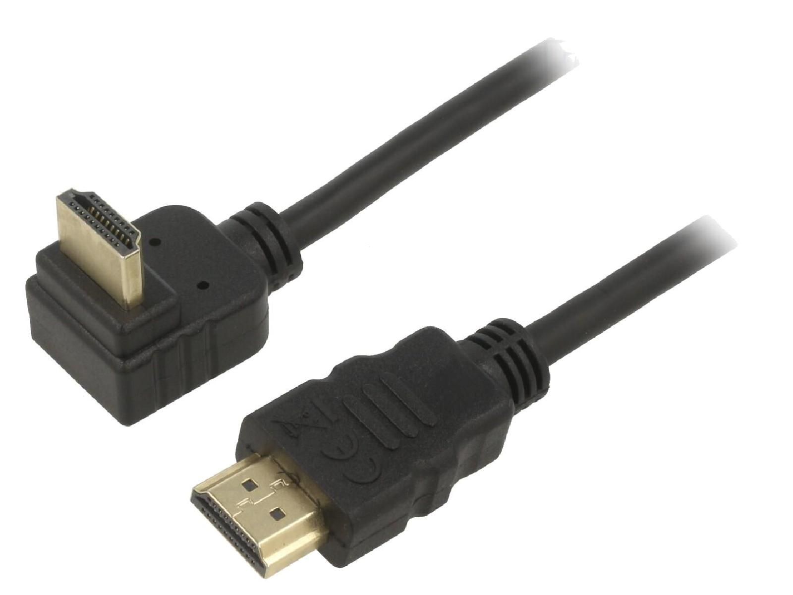 ADNAuto High-Speed HDMI Cable (1m, Black)