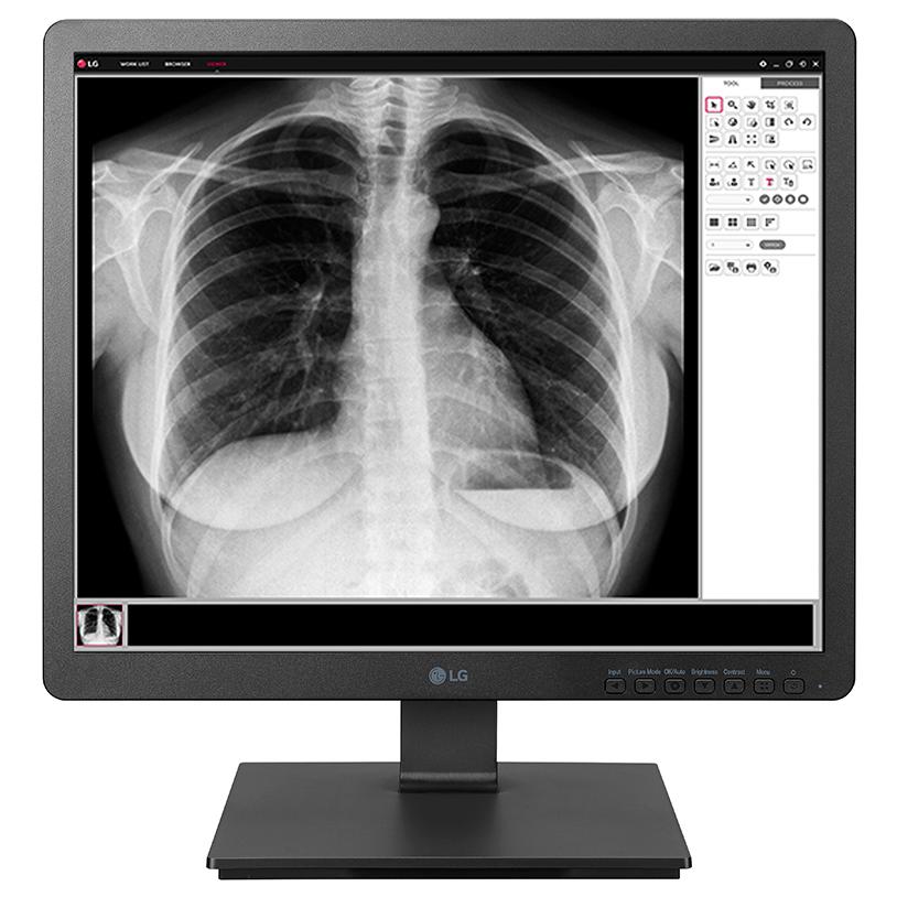 Monitor LG 19HK312C de 19 Pulgadas con Tecnología LED SXGA