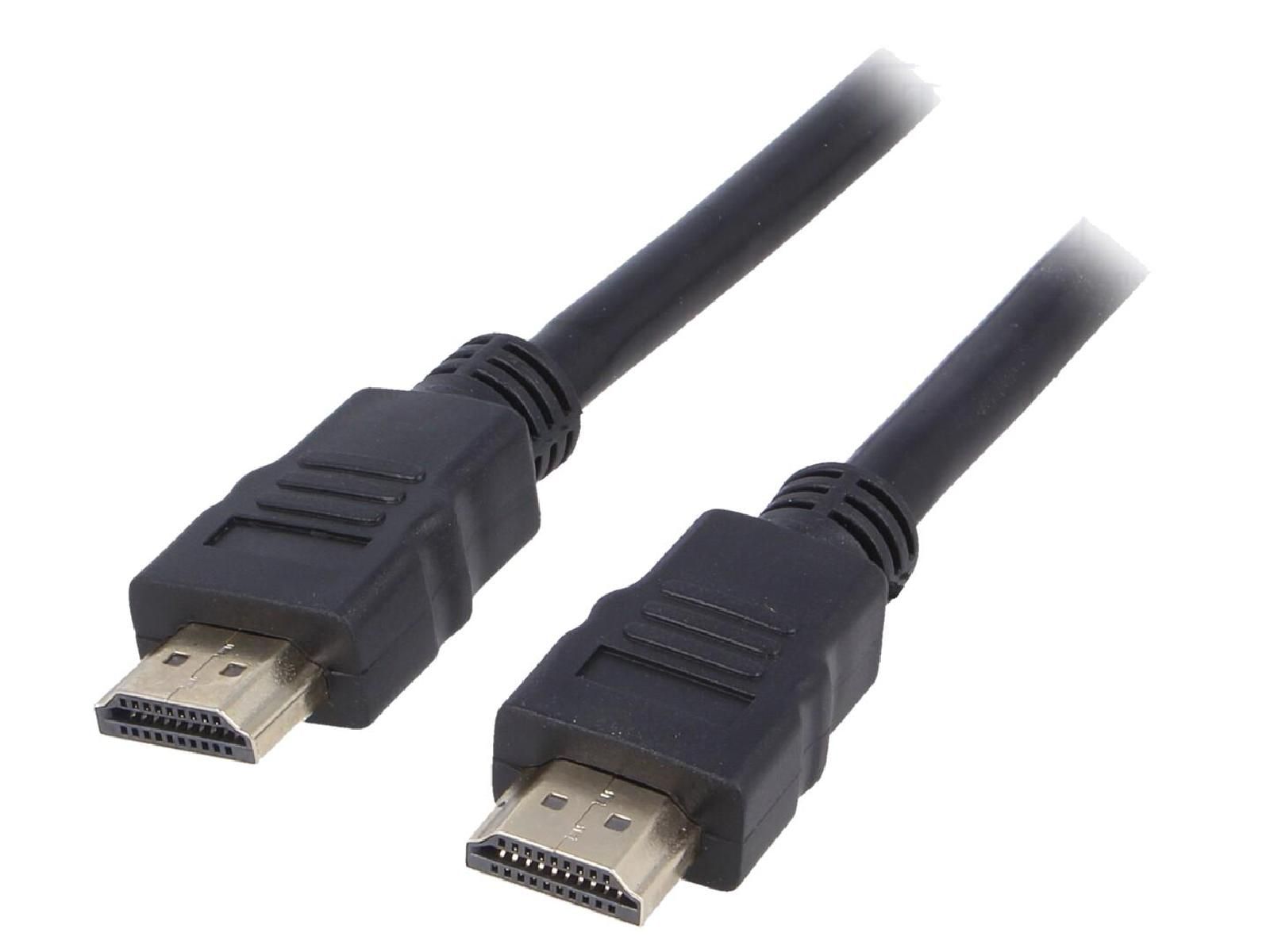 ADNAuto HDMI 1.4 Cable, 1.5m, Black (Two-Sided)
