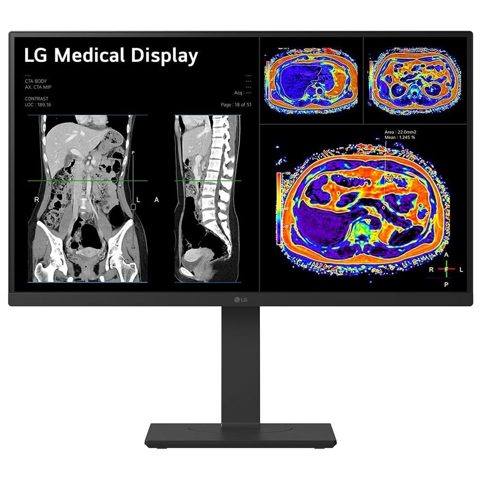 LG 27HS713C-B 27" 4K Ultra HD LED Black Screen