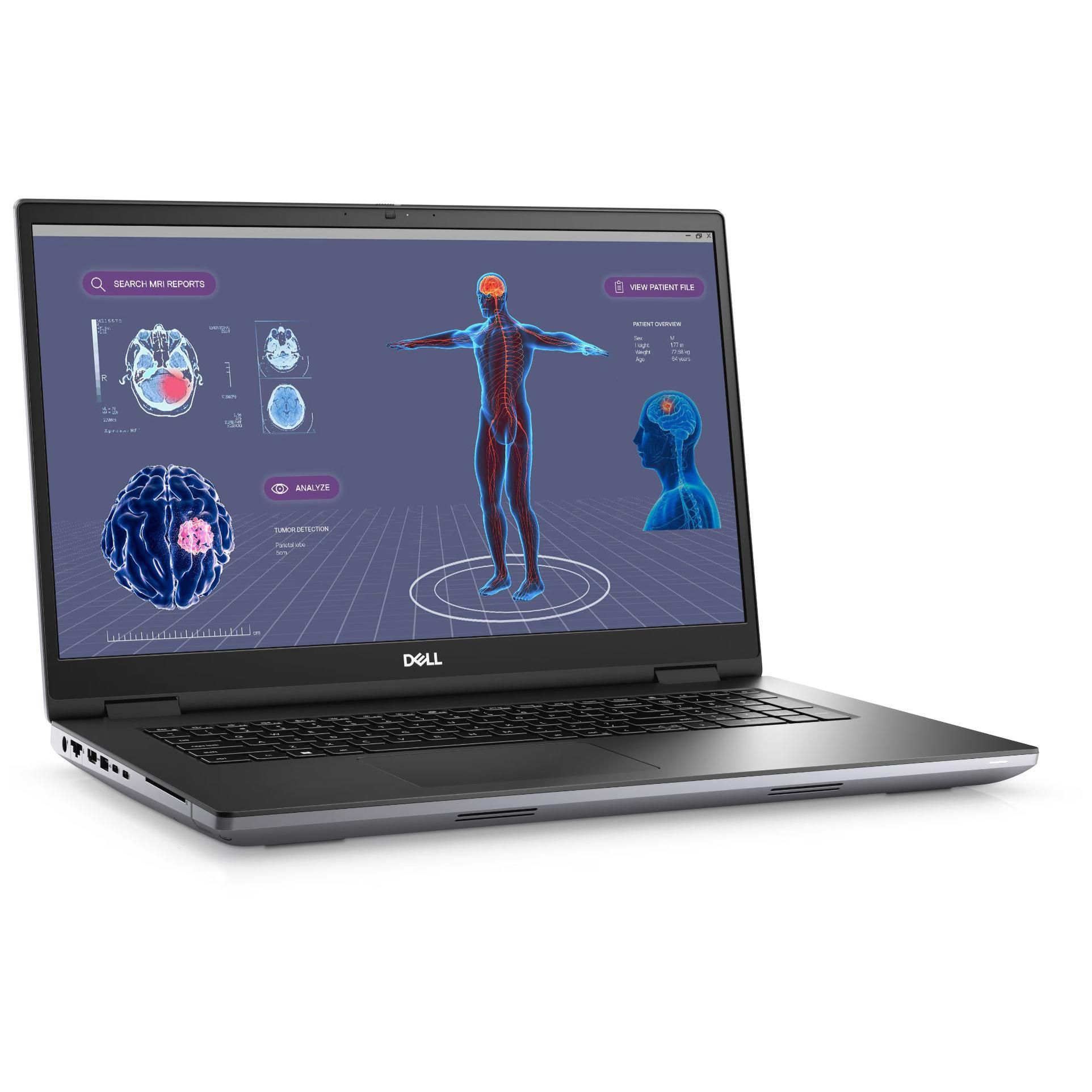 Dell Precision 7780 - 17.3" Core i7 I7-13850HX 32 Go RAM 1 To SSD NVIDIA RTX 3500 Ada - Gris